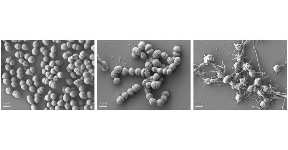 Scanning electron micrographs at 10000× magnification of vancomycin resistant E