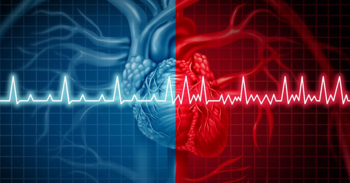 cardiac disorder