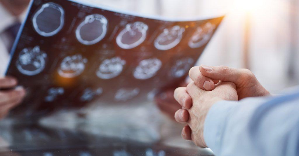 準確率近8成!新AI工具預測癌症轉移 揪生物規律運作邏輯 1 最新「細胞療法」能使高達62%的復發性多形性膠質母細胞瘤患者腫瘤縮小。示意圖。(圖/123RF)