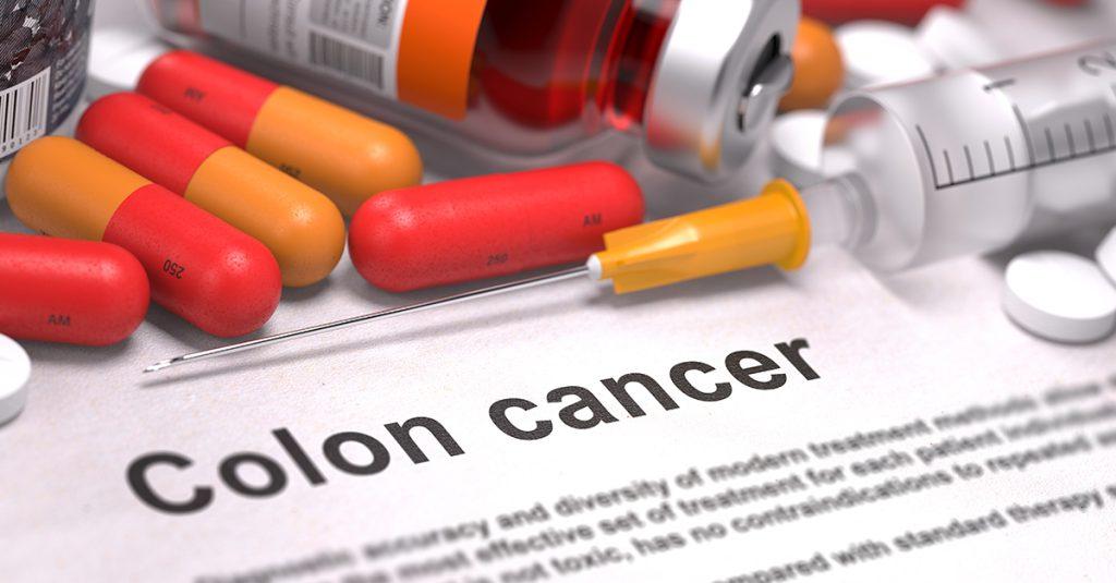 國際臨床研究顯示，對於接受手術與化療後的大腸癌患者，執行有結構的運動計畫能顯著提高整體存活期。（圖／123RF）