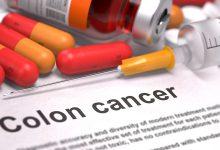 國際臨床研究顯示，對於接受手術與化療後的大腸癌患者，執行有結構的運動計畫能顯著提高整體存活期。（圖／123RF）