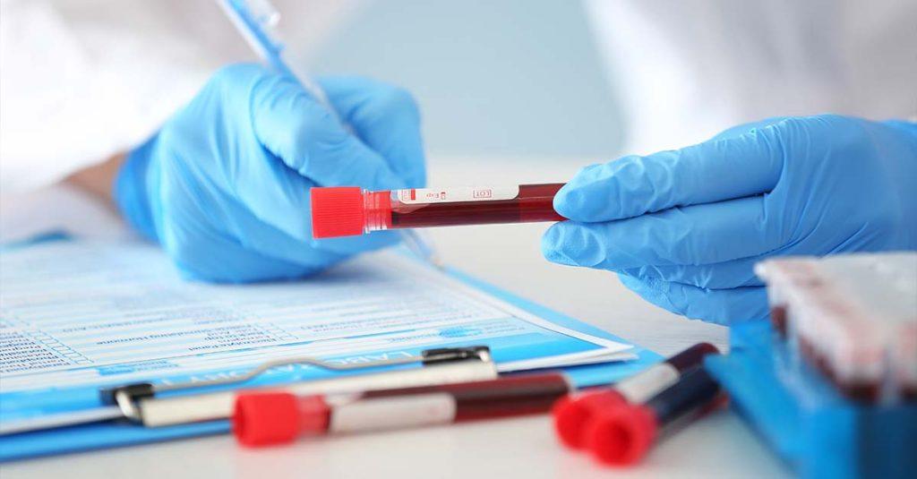 精選 3 一項最新研究指出,肥胖會加速阿茲海默症相關血液生物標誌物(BBMs)的升高。(圖/123RF)